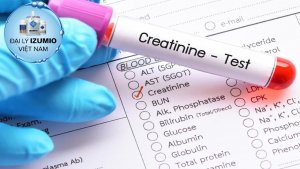 Chỉ số Creatinin trong xét nghiệm suy thận