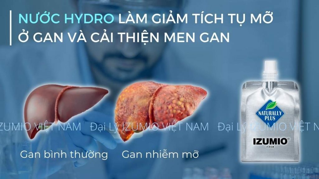 Nước Hydro IZUMIO cải thiện gan nhiễm mỡ